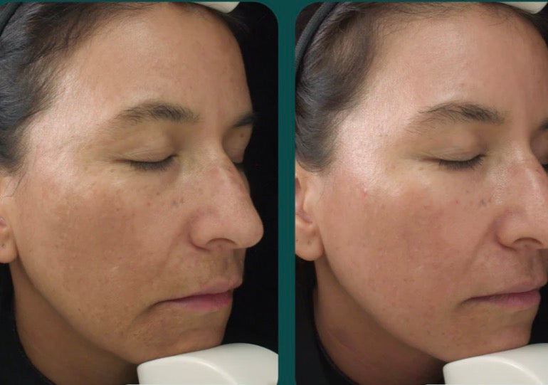 Marini Luminate face lotion